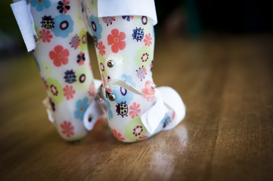 afo shoes for babies